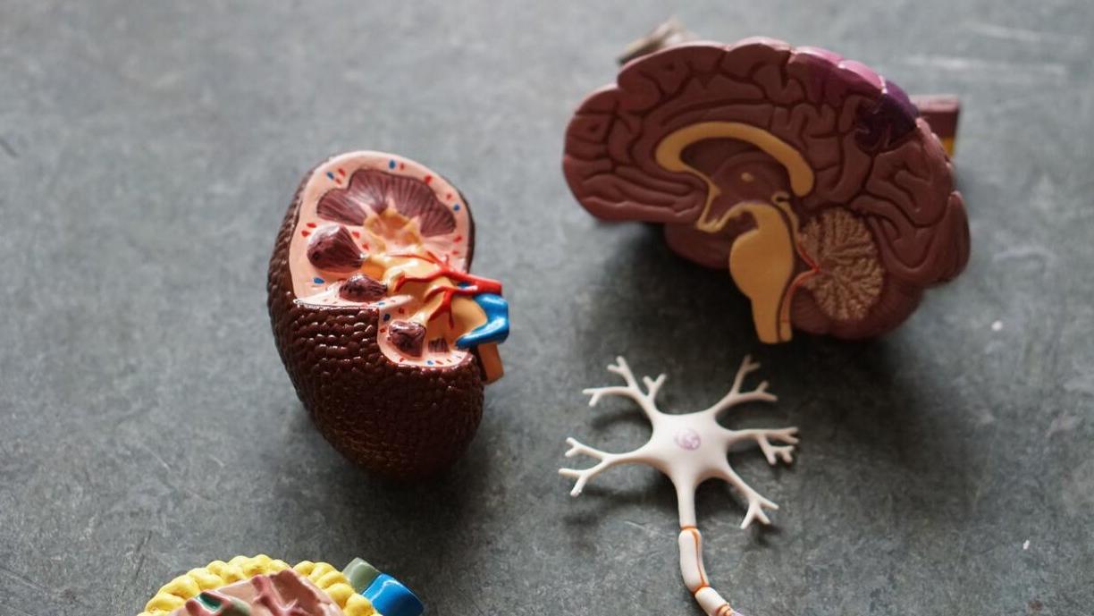 Muovinen malli aivoista, jonka palasia on pöydällä.